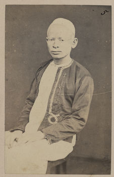 Malgache albinos