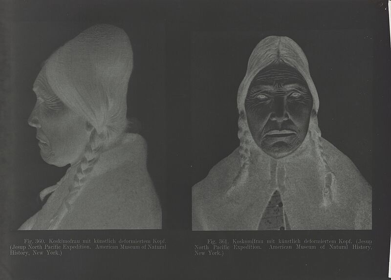 Déformation antéro-postérieure droite du crâne d'une femme Kwakiutl